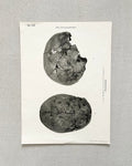 Vintage Anatomic Bronze Age Skull Print