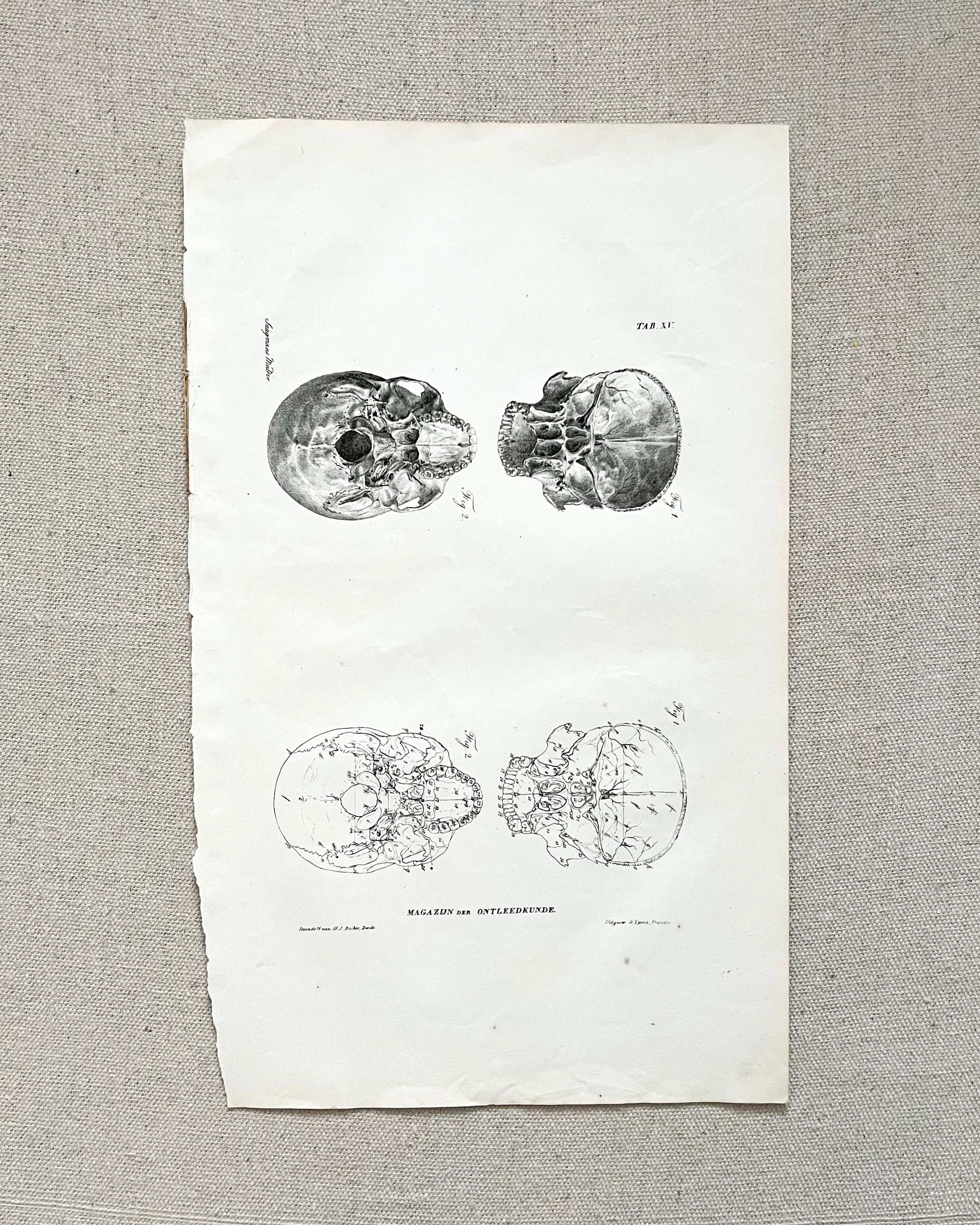 Antique Anatomic Skull Diagram Print