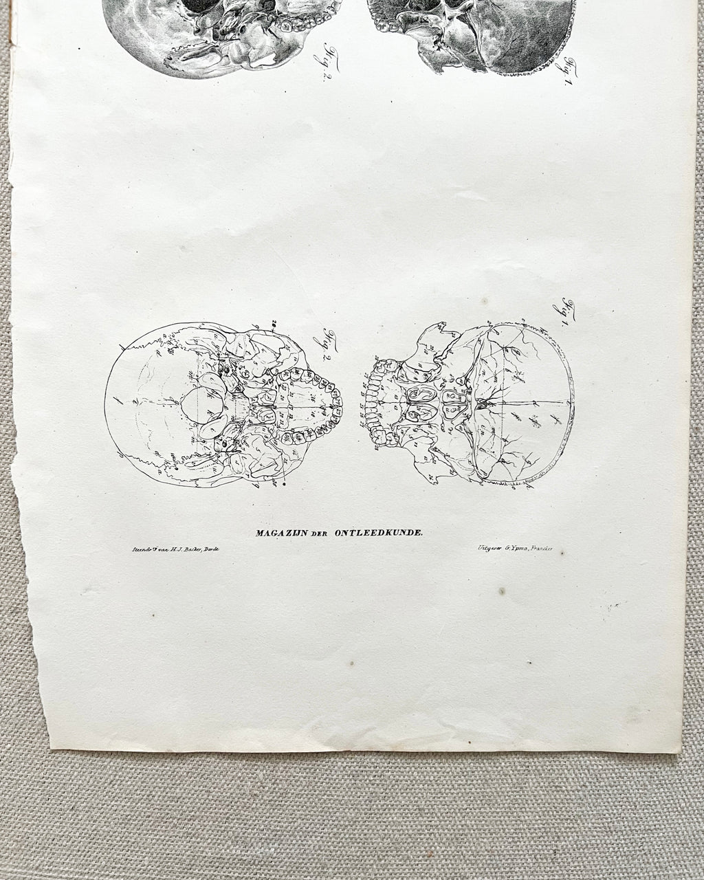 Antique Anatomic Skull Diagram Print