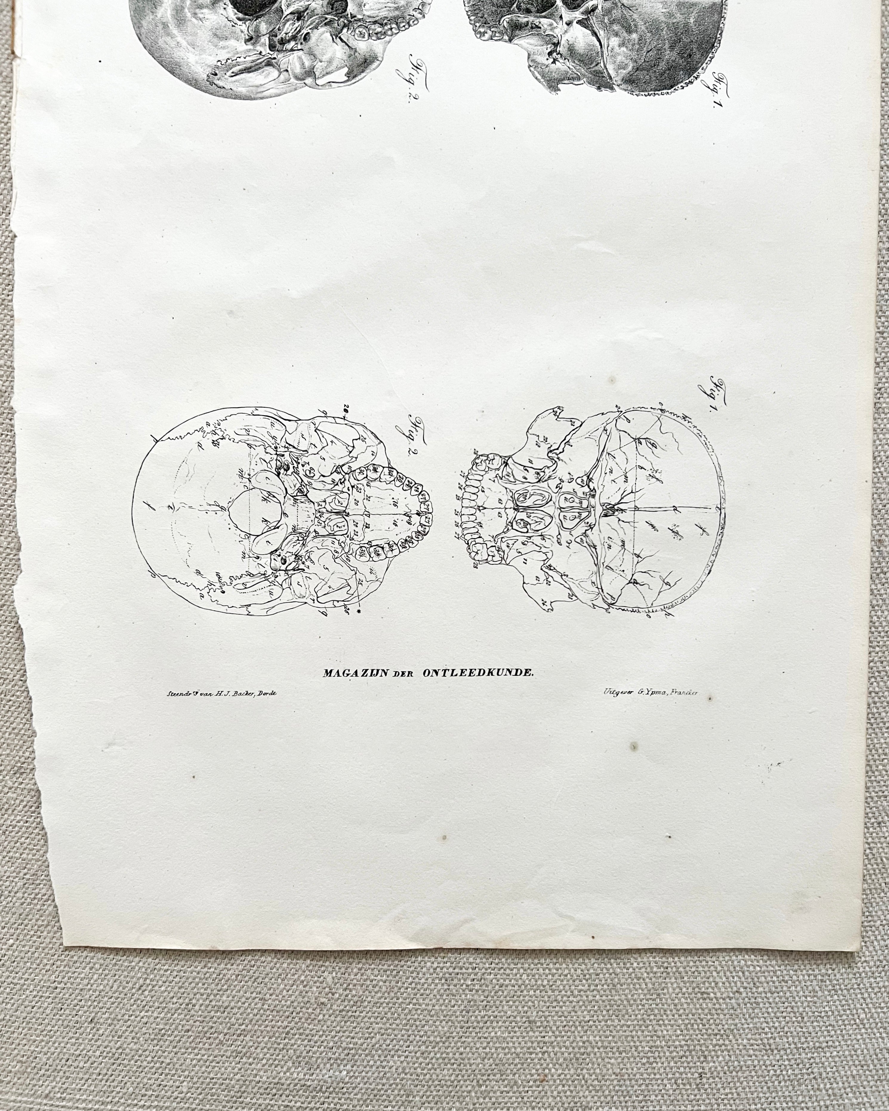 Antique Anatomic Skull Diagram Print