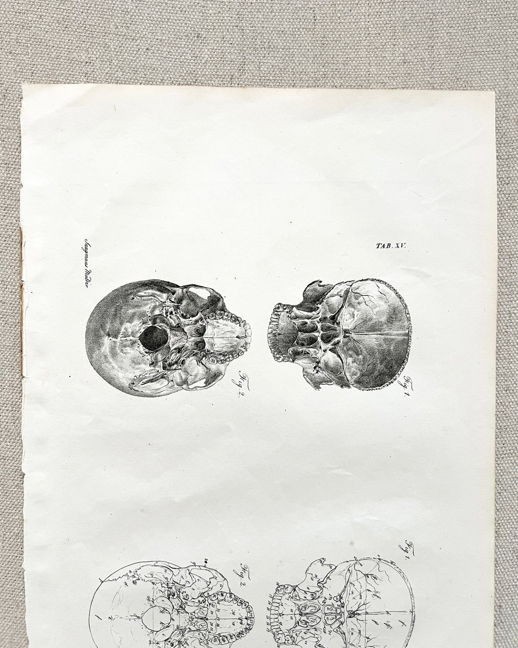 Antique Anatomic Skull Diagram Print