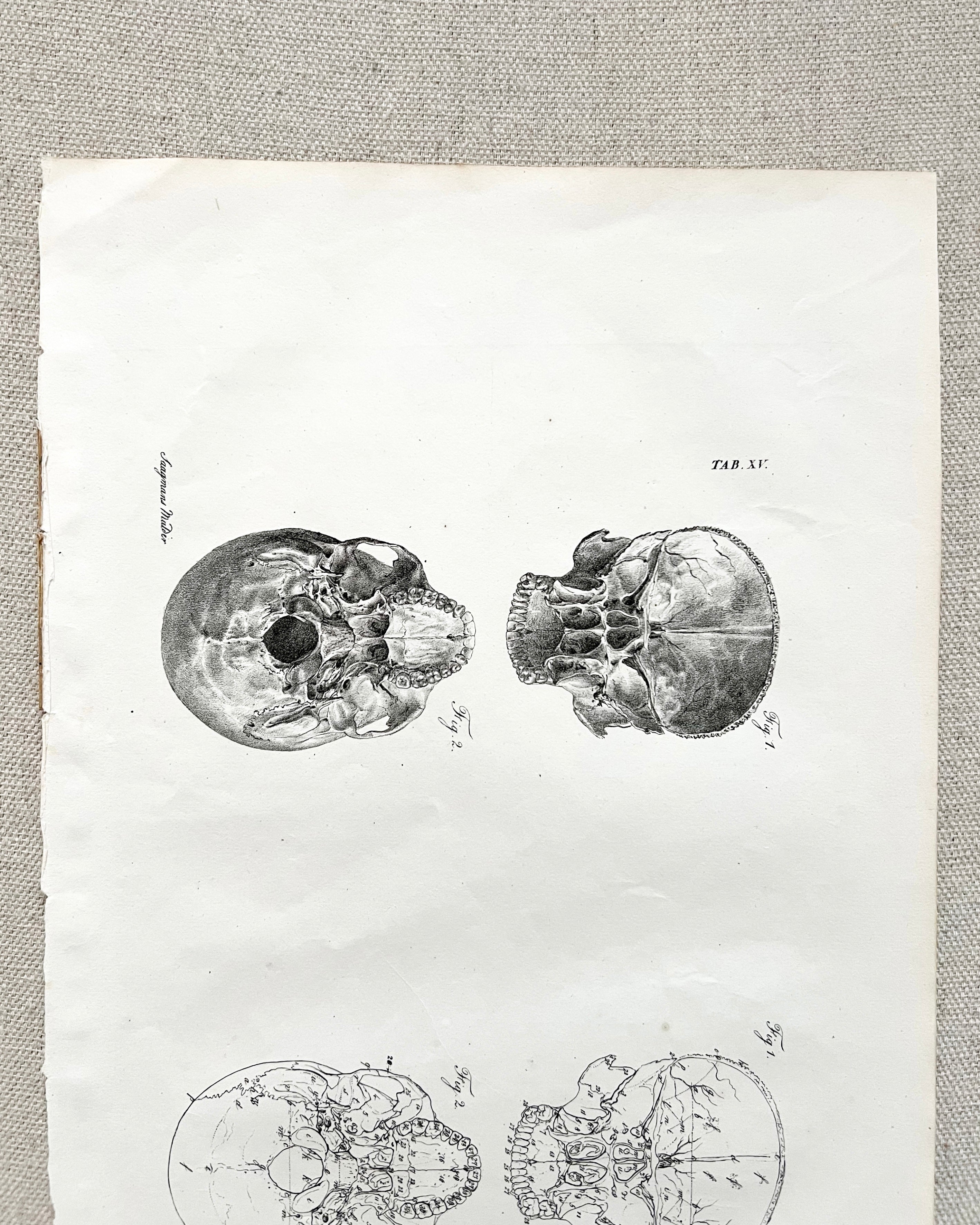 Antique Anatomic Skull Diagram Print